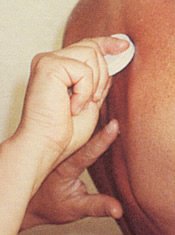 Gua Sha Treatment