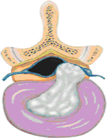 spine view