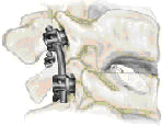 spinal view2